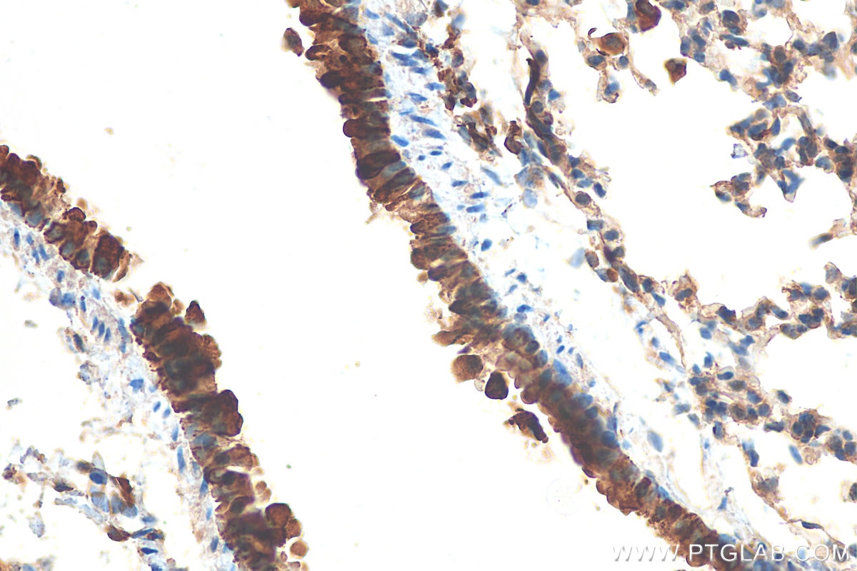 IHC staining of mouse lung using 10490-1-AP