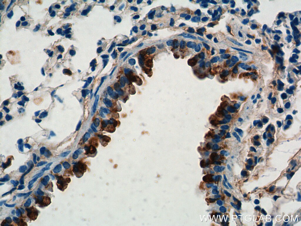IHC staining of mouse lung using 10490-1-AP