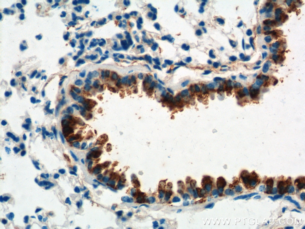 Immunohistochemistry (IHC) staining of mouse lung tissue using Uteroglobin/CC10 Polyclonal antibody (10490-1-AP)