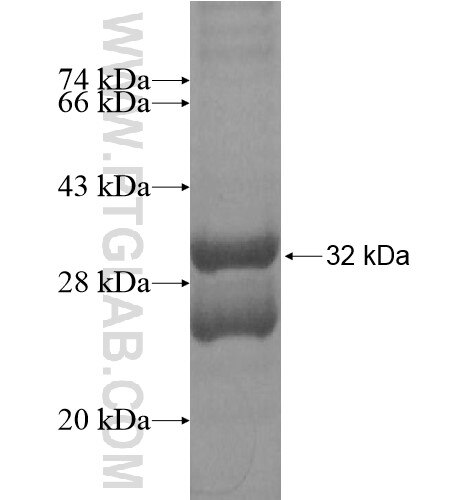 SCGB1D1 fusion protein Ag15608 SDS-PAGE