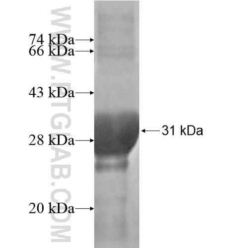 Mammaglobin fusion protein Ag15609 SDS-PAGE