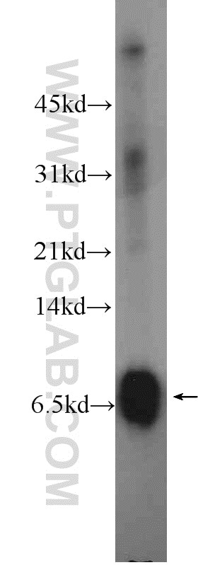 Western Blot (WB) analysis of MCF-7 cells using Mammaglobin A Polyclonal antibody (23501-1-AP)