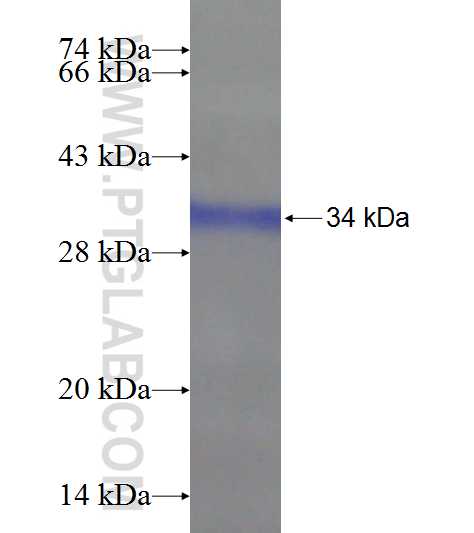 SCGB2A2 fusion protein Ag20122 SDS-PAGE