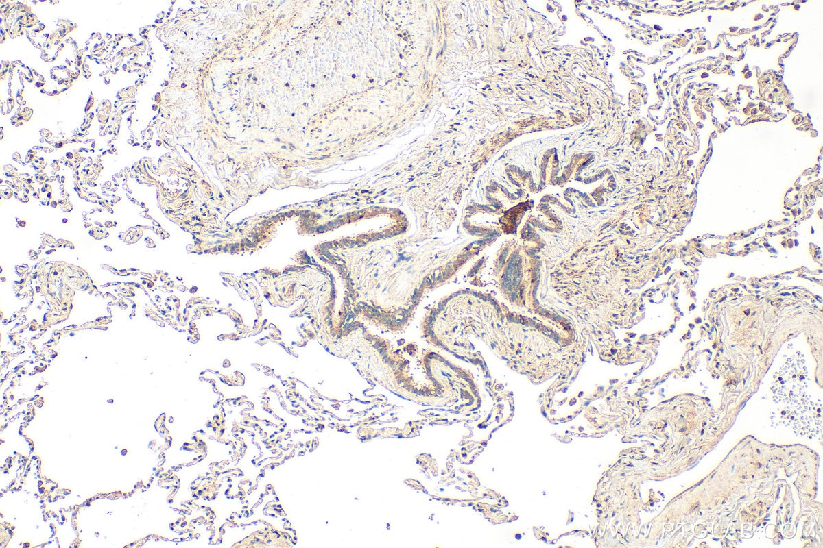 IHC staining of human lung using 34191-1-AP (same clone as 34191-1-PBS) Immunohistochemistry (IHC) staining of human lung tissue using SCGB3A1 Polyclonal antibody (34191-1-AP)