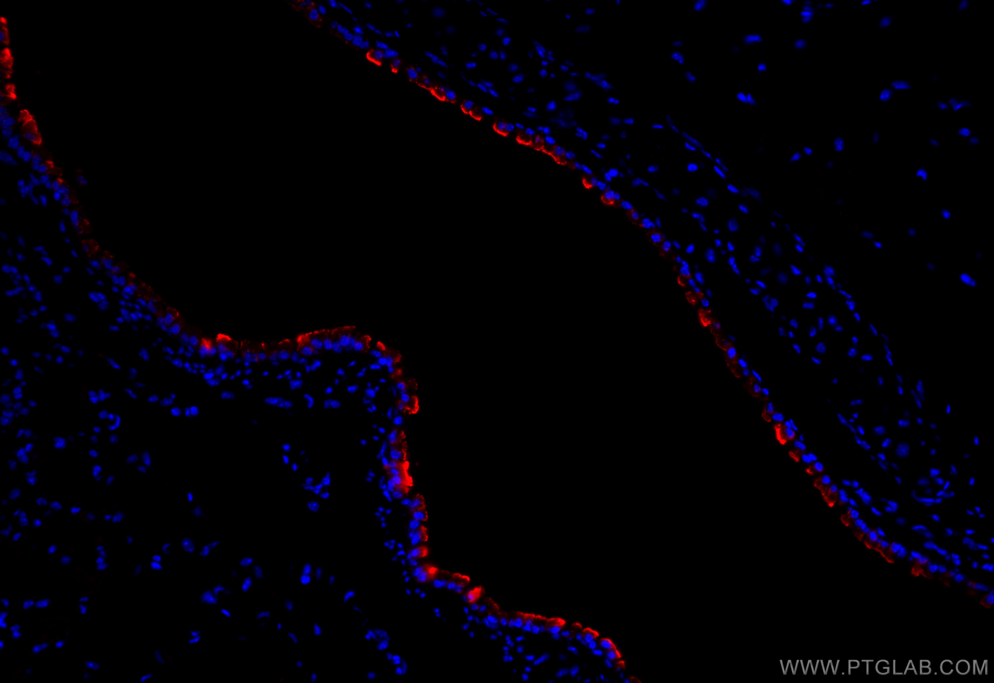 Immunofluorescence (IF) / fluorescent staining of mouse lung tissue using SCGB3A2 Polyclonal antibody (26228-1-AP)