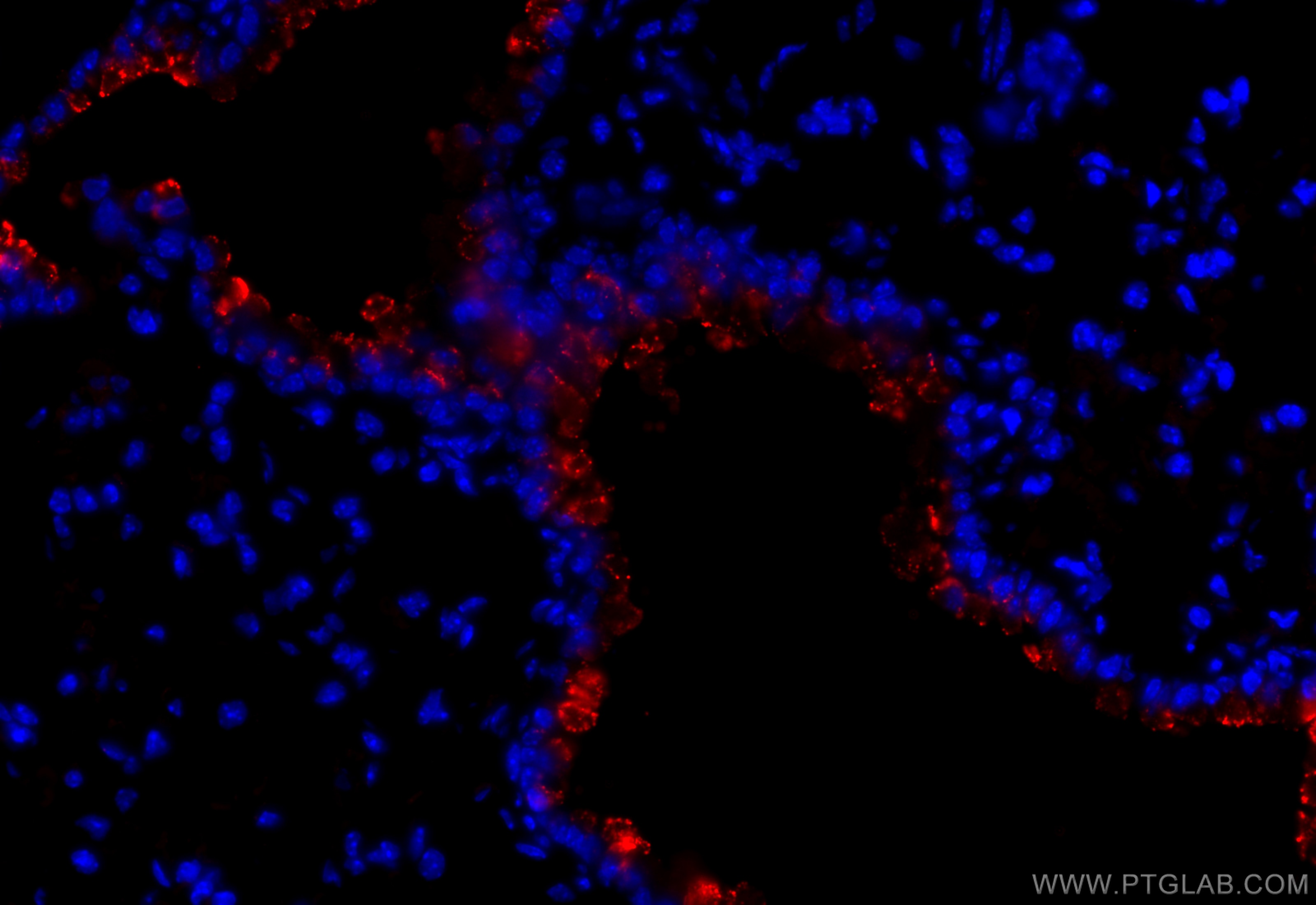 Immunofluorescence (IF) / fluorescent staining of mouse lung tissue using SCGB3A2 Polyclonal antibody (26228-1-AP)