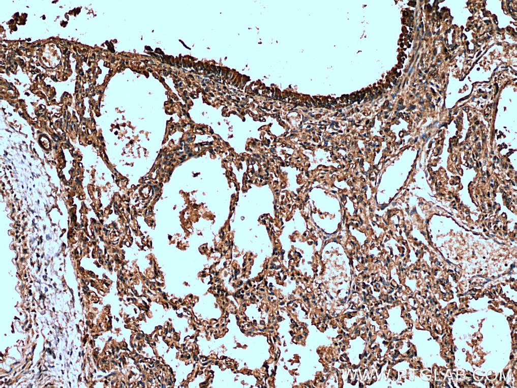IHC staining of human lung using 26228-1-AP