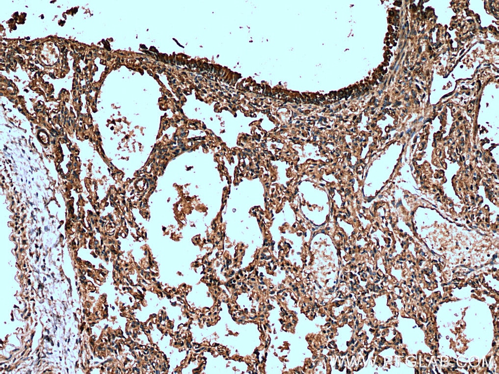 Immunohistochemistry (IHC) staining of human lung tissue using SCGB3A2 Polyclonal antibody (26228-1-AP)