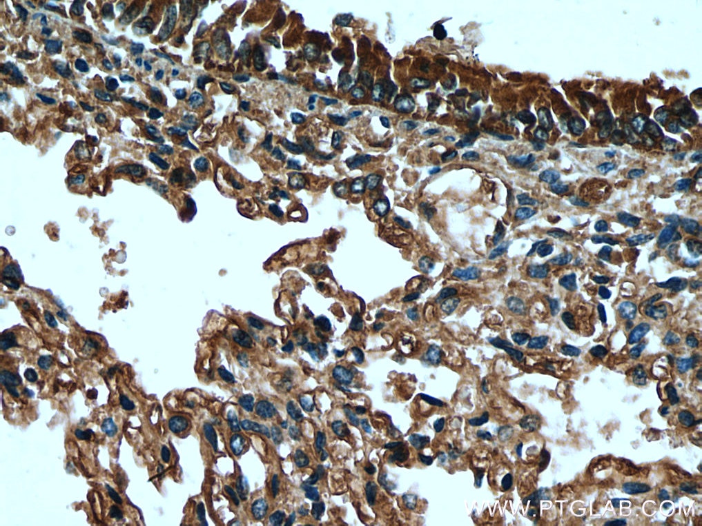 Immunohistochemistry (IHC) staining of human lung tissue using SCGB3A2 Polyclonal antibody (26228-1-AP)