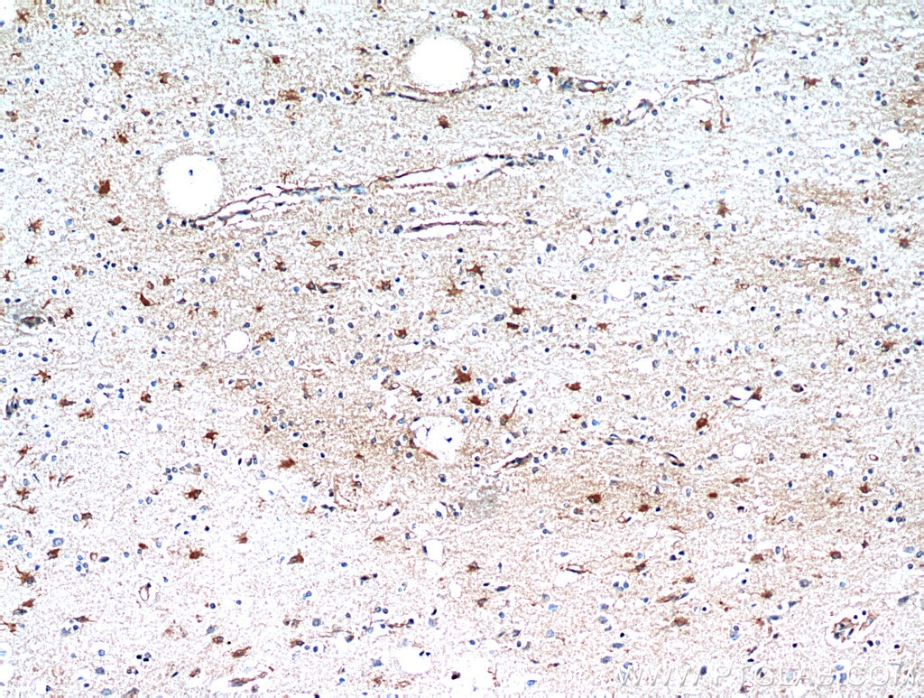 Immunohistochemistry (IHC) staining of human brain tissue using SCGBL Polyclonal antibody (21142-1-AP)