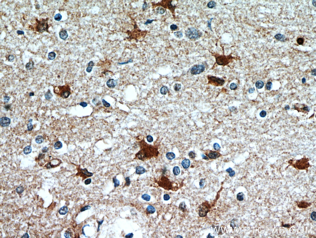 IHC staining of human brain using 21142-1-AP