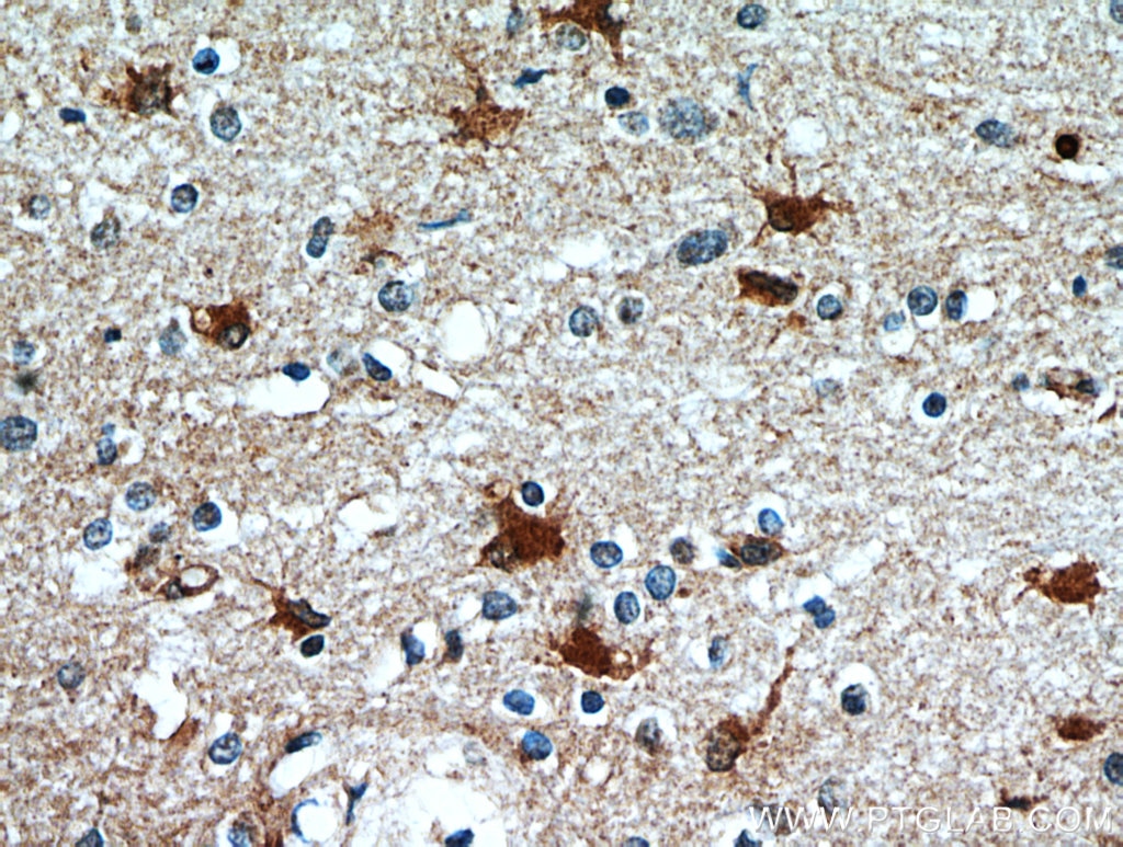 Immunohistochemistry (IHC) staining of human brain tissue using SCGBL Polyclonal antibody (21142-1-AP)