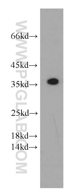 Western Blot (WB) analysis of human skeletal muscle tissue using SCGF Polyclonal antibody (55019-1-AP)