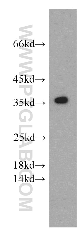 Western Blot (WB) analysis of human skeletal muscle tissue using SCGF Polyclonal antibody (55019-1-AP)