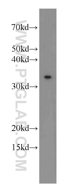 Western Blot (WB) analysis of human skeletal muscle tissue using SCGF Polyclonal antibody (55019-1-AP)