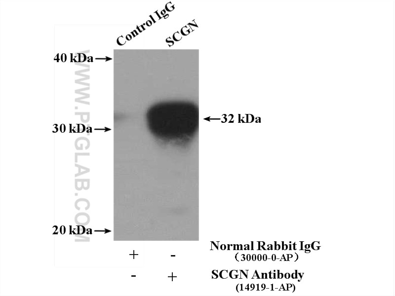 Immunoprecipitation (IP) experiment of mouse brain tissue using SCGN Polyclonal antibody (14919-1-AP)