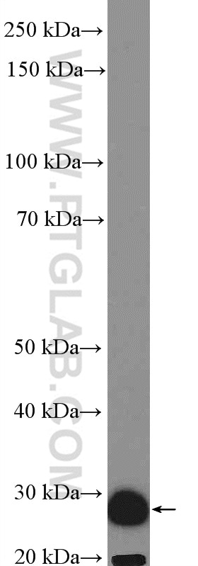 Western Blot (WB) analysis of fetal human brain tissue using SCGN Polyclonal antibody (14919-1-AP)