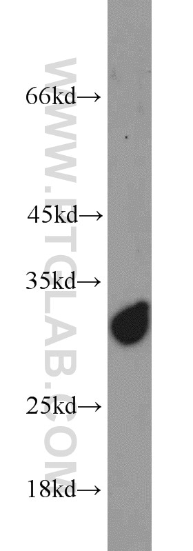 Western Blot (WB) analysis of rat brain tissue using SCGN Polyclonal antibody (14919-1-AP)