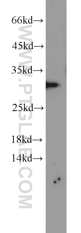 Western Blot (WB) analysis of rat brain tissue using SCGN Polyclonal antibody (14919-1-AP)