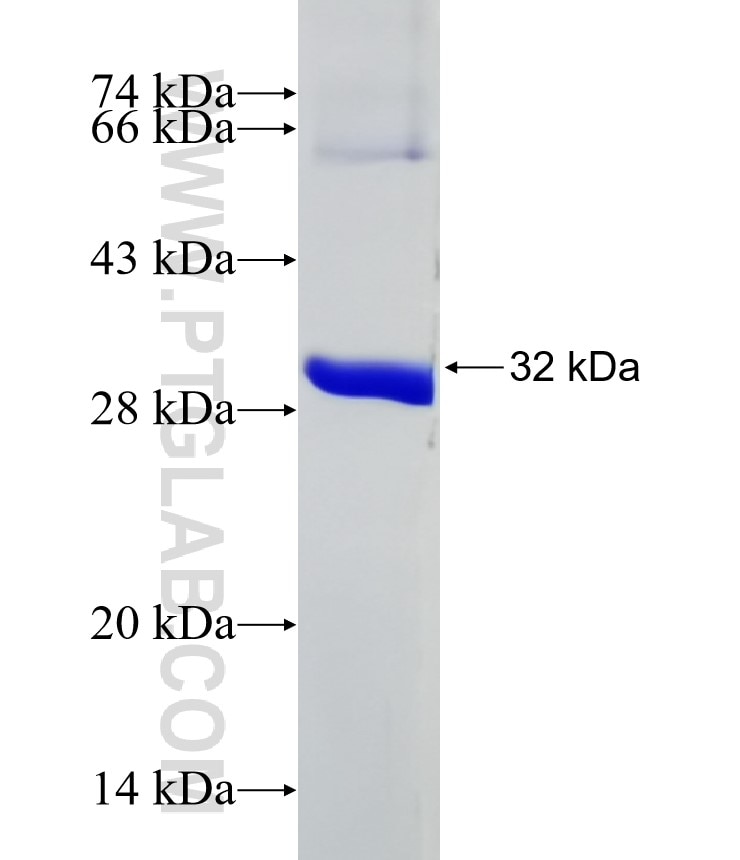 SCGN fusion protein Ag6548 SDS-PAGE
