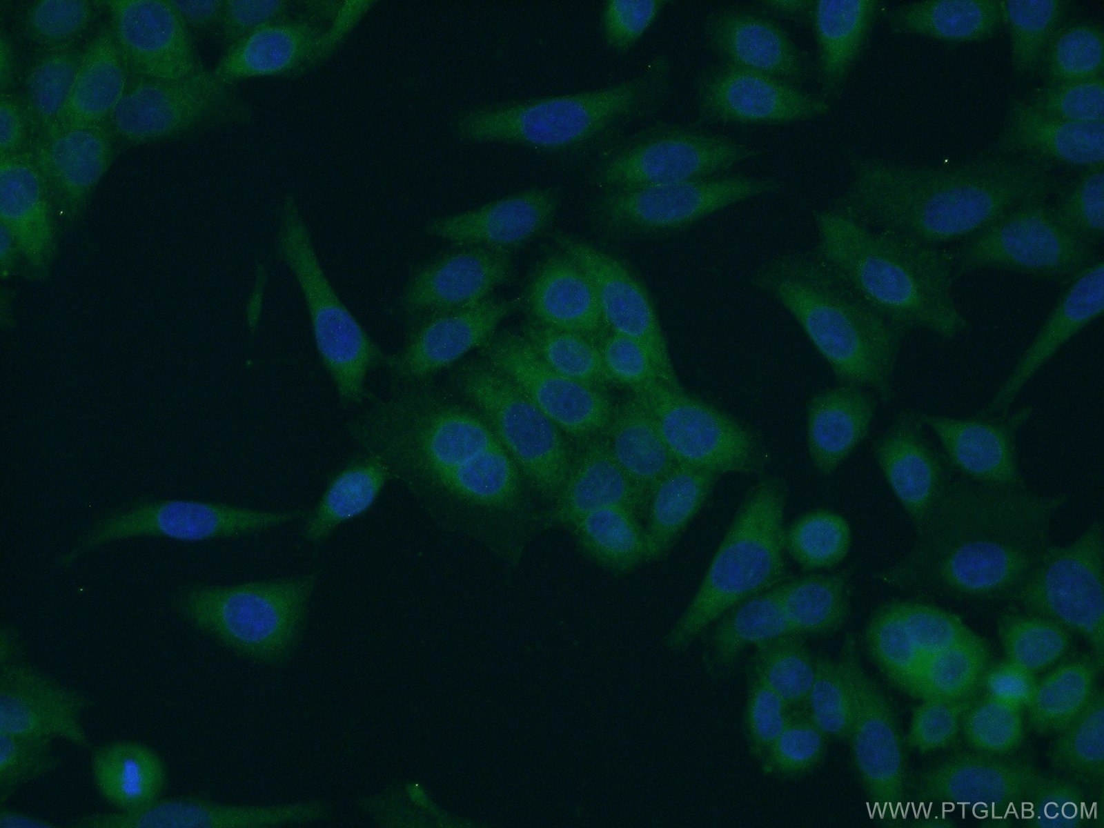 Immunofluorescence (IF) / fluorescent staining of HeLa cells using SCHIP1 Polyclonal antibody (11939-1-AP)