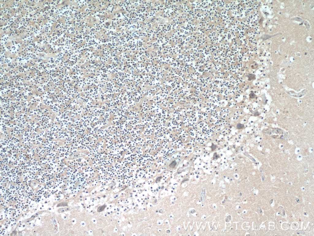 Immunohistochemistry (IHC) staining of human cerebellum tissue using SCHIP1 Polyclonal antibody (11939-1-AP)