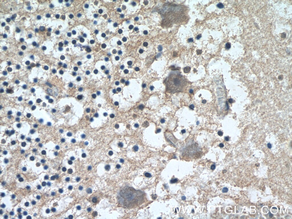 Immunohistochemistry (IHC) staining of human cerebellum tissue using SCHIP1 Polyclonal antibody (11939-1-AP)