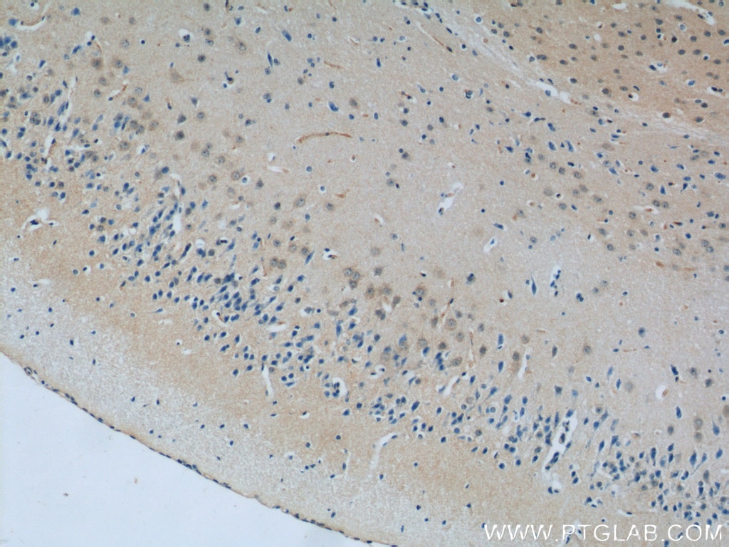 Immunohistochemistry (IHC) staining of mouse brain tissue using SCHIP1 Polyclonal antibody (11939-1-AP)
