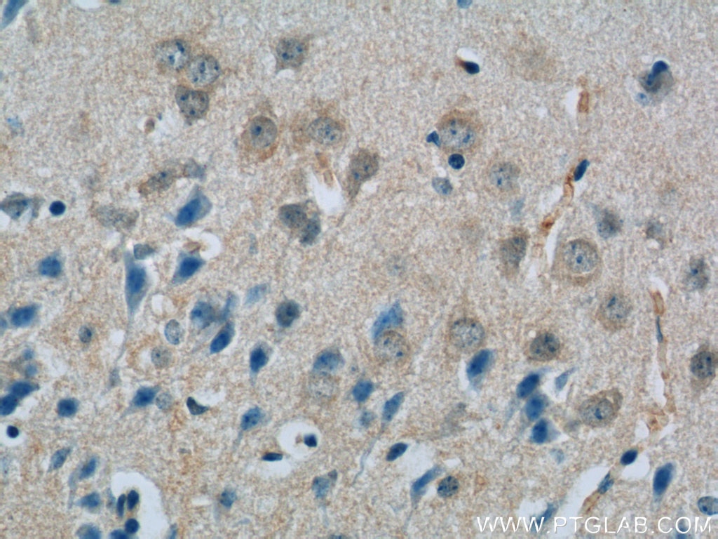 Immunohistochemistry (IHC) staining of mouse brain tissue using SCHIP1 Polyclonal antibody (11939-1-AP)