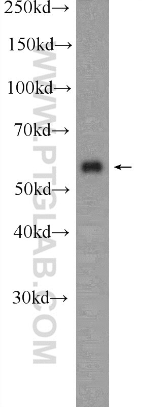 Western Blot (WB) analysis of HeLa cells using SCHIP1 Polyclonal antibody (11939-1-AP)
