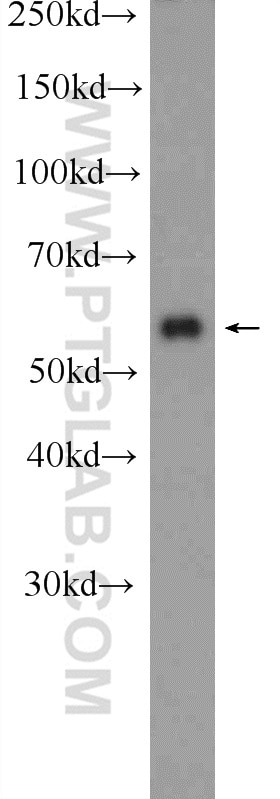 Western Blot (WB) analysis of HeLa cells using SCHIP1 Polyclonal antibody (11939-1-AP)