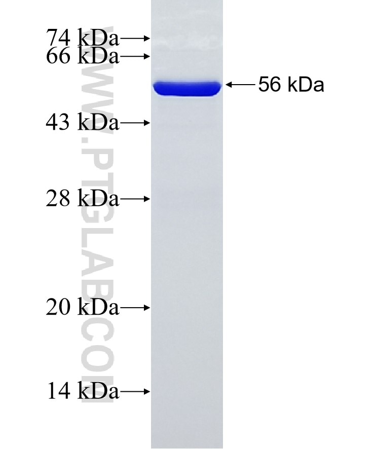 SCHIP1 fusion protein Ag2536 SDS-PAGE
