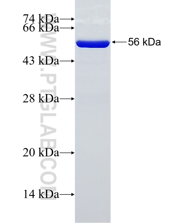SCHIP1 fusion protein Ag2536 SDS-PAGE