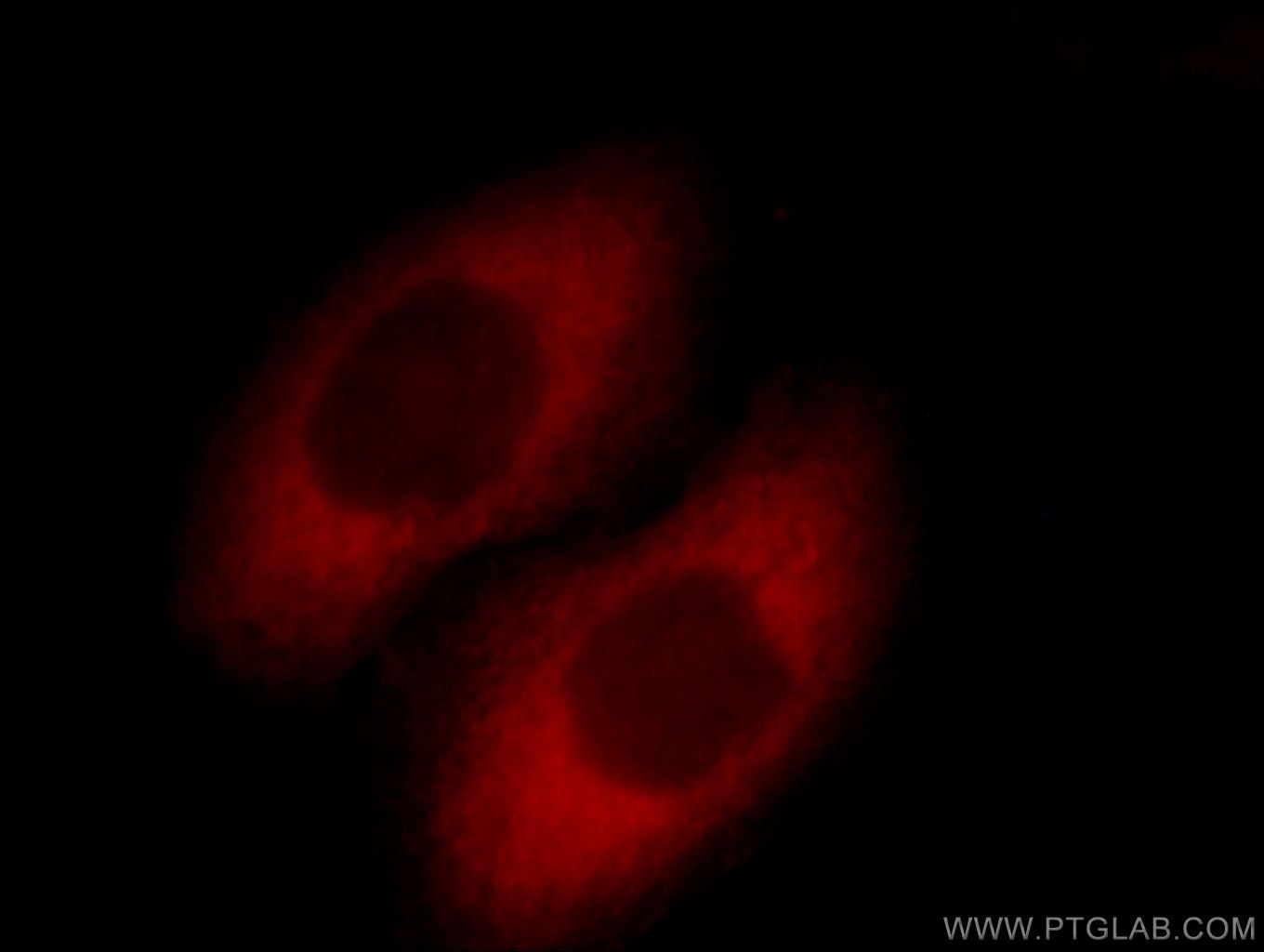 Immunofluorescence (IF) / fluorescent staining of HepG2 cells using SCIN Polyclonal antibody (11579-1-AP)