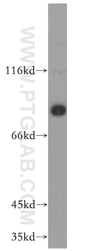 Western Blot (WB) analysis of human placenta tissue using SCIN Polyclonal antibody (11579-1-AP)