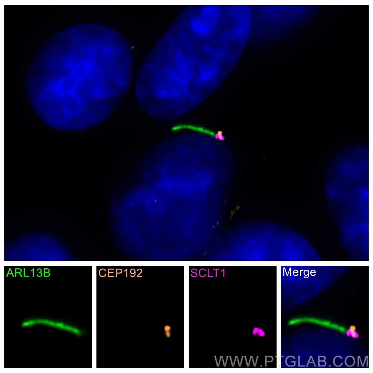 Immunofluorescence (IF) / fluorescent staining of hTERT-RPE1 cells using SCLT1 Polyclonal antibody (14875-1-AP)