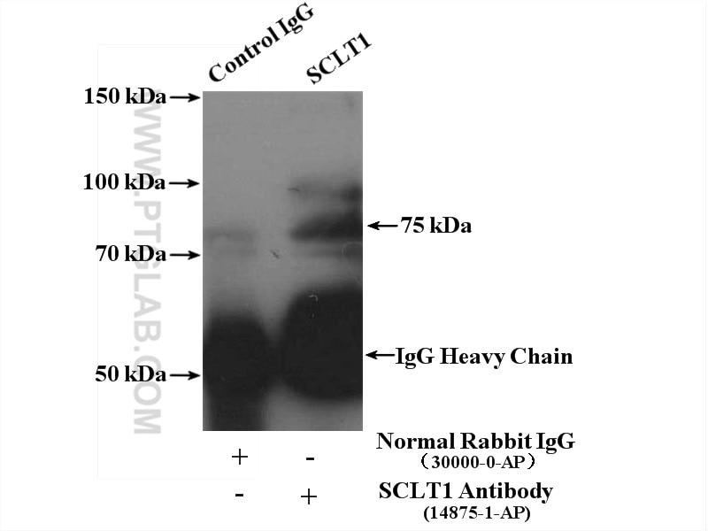 Immunoprecipitation (IP) experiment of human placenta tissue using SCLT1 Polyclonal antibody (14875-1-AP)
