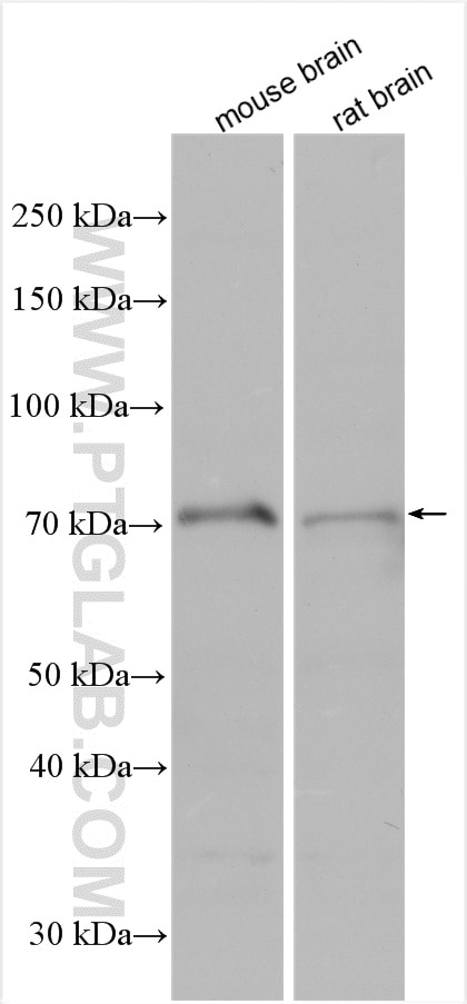 Western Blot (WB) analysis of various lysates using SCLT1 Polyclonal antibody (14875-1-AP)