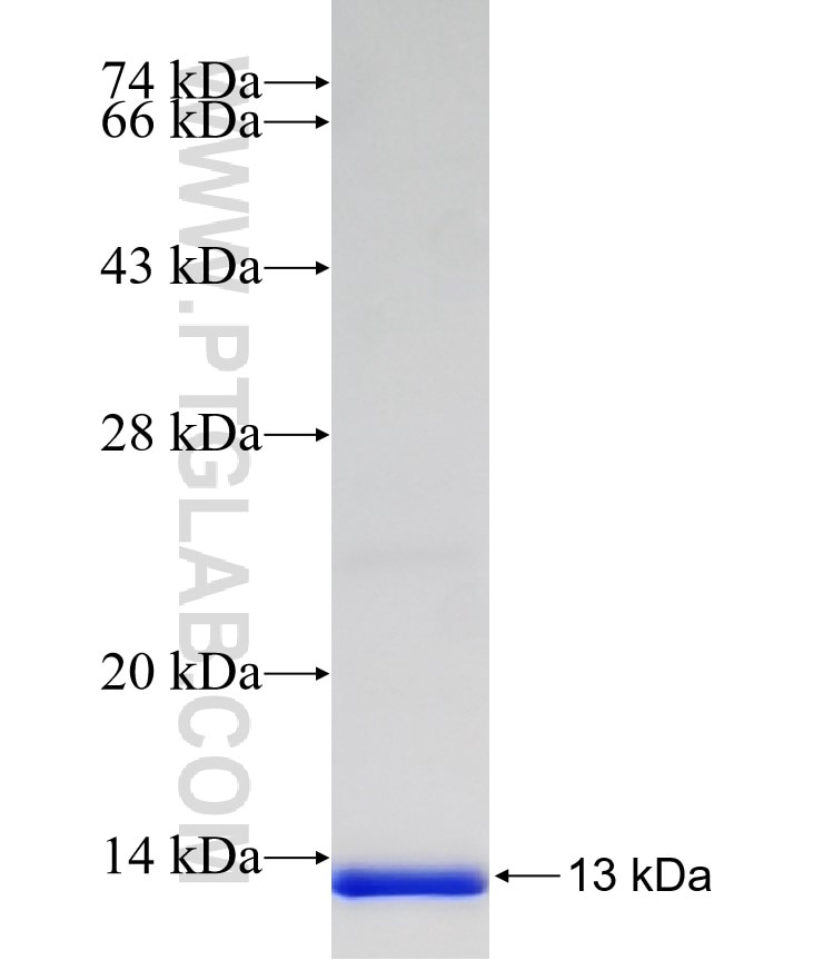 SCLT1 fusion protein Ag6806 SDS-PAGE