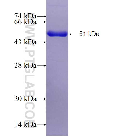 SCLY fusion protein Ag28822 SDS-PAGE