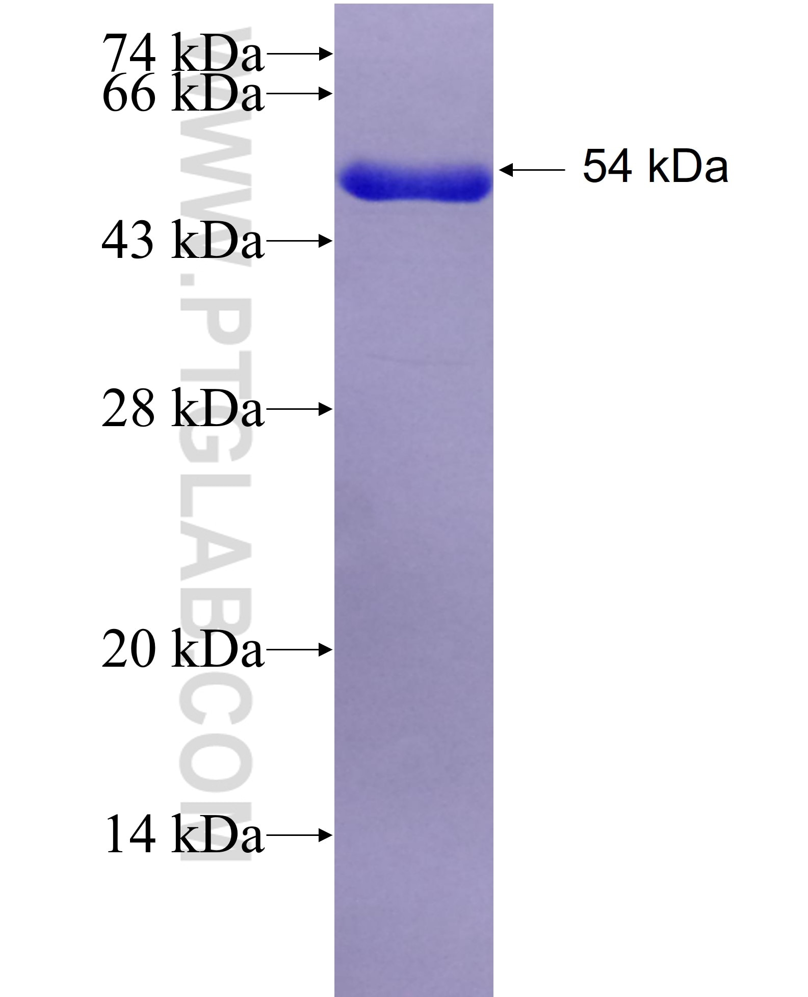 SCLY fusion protein Ag28822 SDS-PAGE