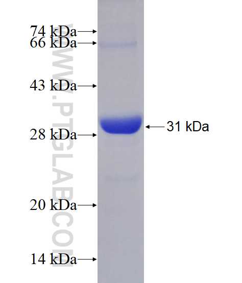 SCLY fusion protein Ag28841 SDS-PAGE
