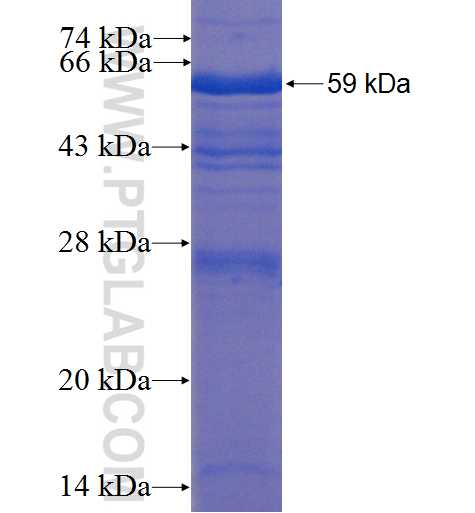 SCLY fusion protein Ag0972 SDS-PAGE