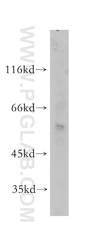 Western Blot (WB) analysis of HT-1080 cells using SCMH1 Polyclonal antibody (11489-1-AP)