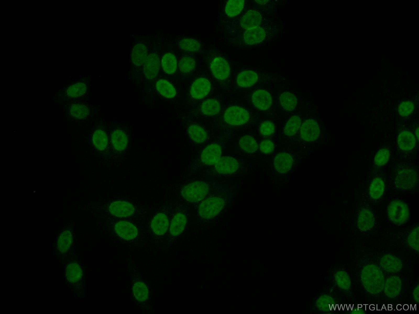 Immunofluorescence (IF) / fluorescent staining of HepG2 cells using SCML1 Polyclonal antibody (15093-1-AP)