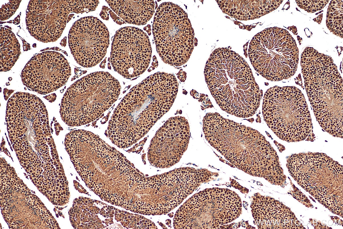 Immunohistochemistry (IHC) staining of mouse testis tissue using SCML1 Polyclonal antibody (15093-1-AP)