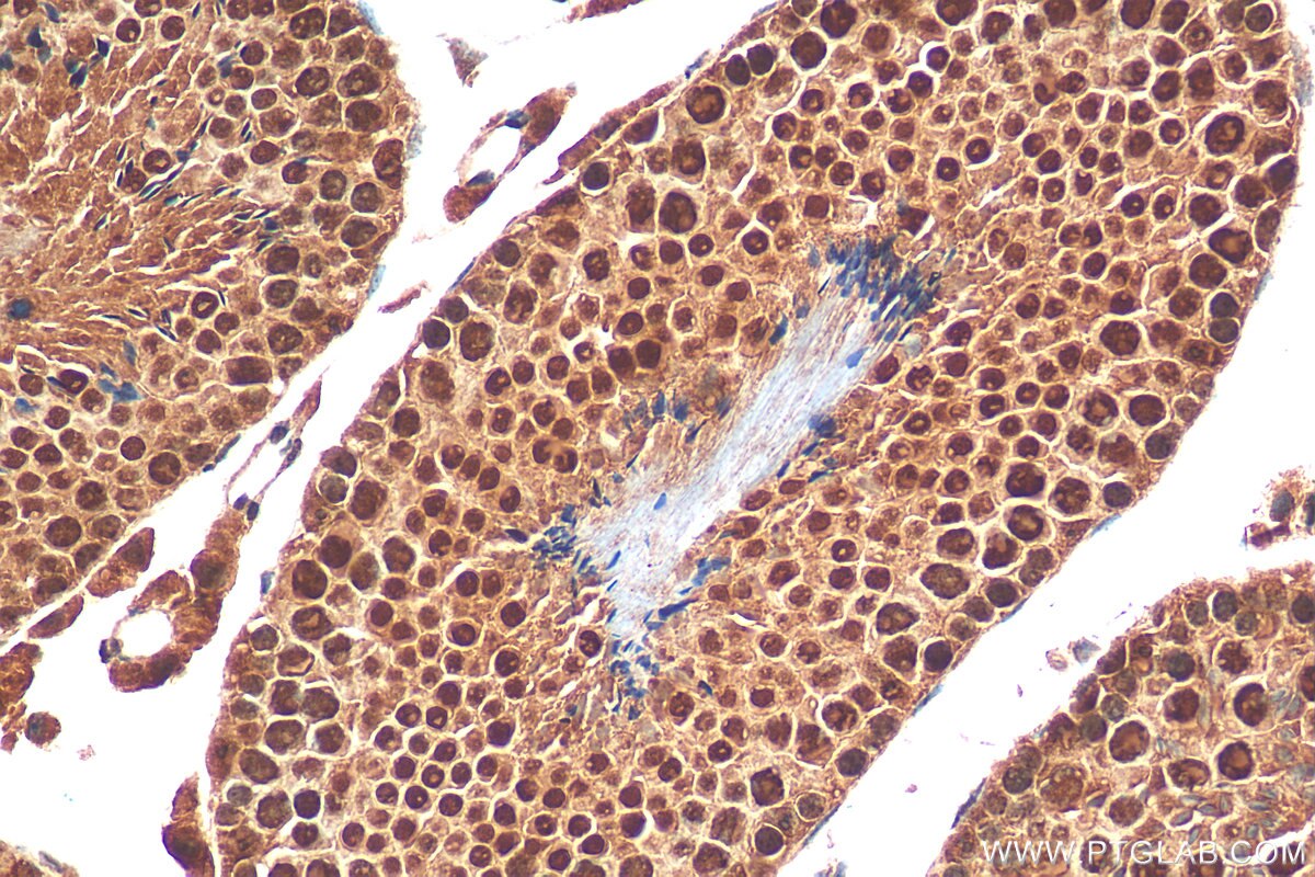 Immunohistochemistry (IHC) staining of mouse testis tissue using SCML1 Polyclonal antibody (15093-1-AP)