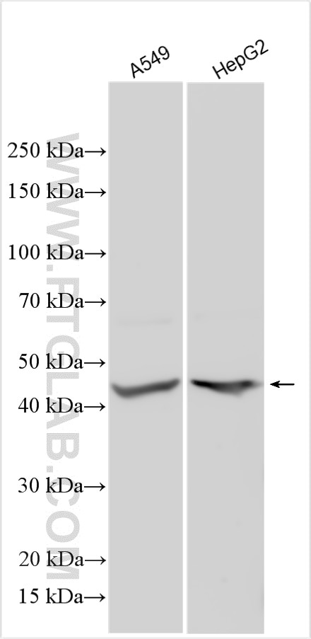 Western Blot (WB) analysis of various lysates using SCML1 Polyclonal antibody (30257-1-AP)