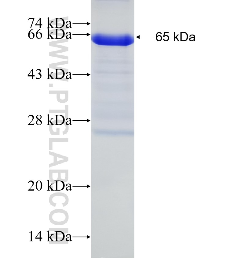 SCML1 fusion protein Ag5107 SDS-PAGE