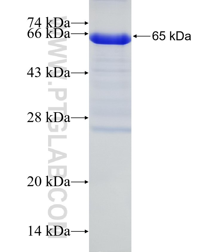 SCML1 fusion protein Ag5107 SDS-PAGE